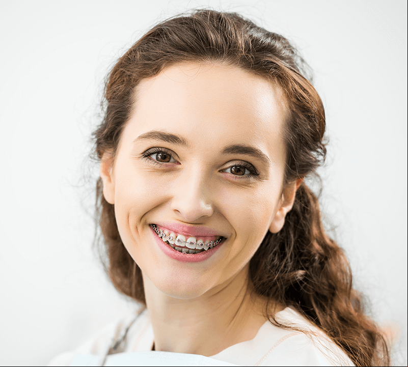 braces filter app